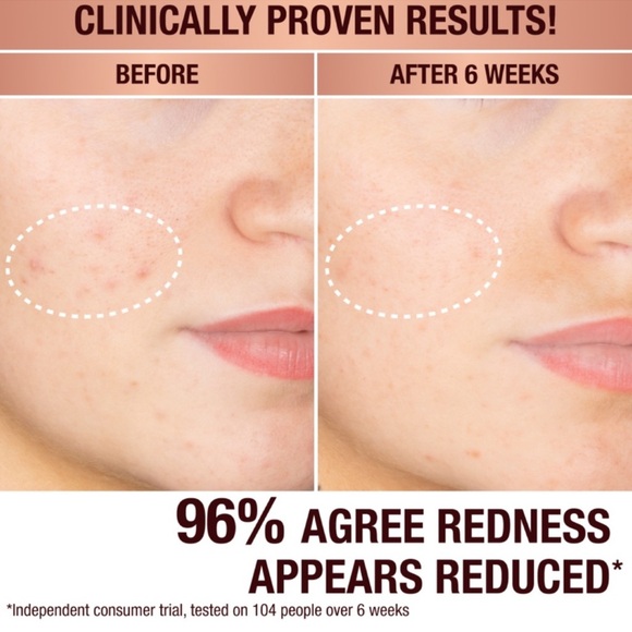 Charlotte Tilbury Dark Spot Correcting Radiance Recovery Serum 30ml - Picture 4 of 12